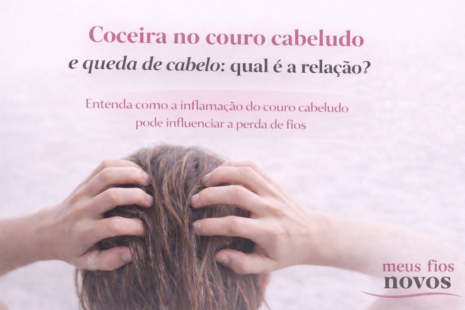 Coceira no couro cabeludo e queda de cabelo: qual é a relação?