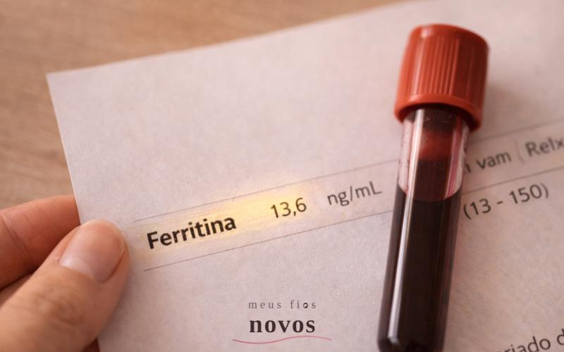 Ferritina baixa causa queda de cabelo?